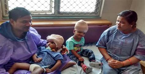 Odisha Twin Separated Through Indias First Craniopagus Surgery Dies