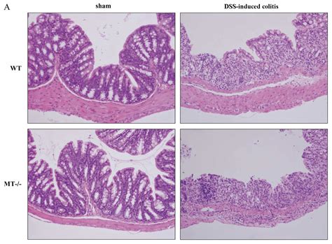 This page is about small intestine vs colon histology,contains cell types. Role of metallothionein in murine experimental colitis