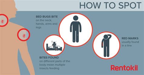 It is also important as it will help detect an infestation. Help! My Airbnb gave me bug bites! First Derm