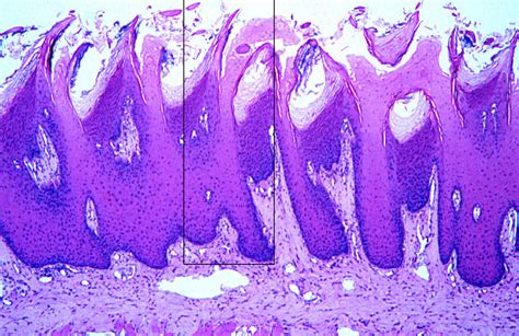 Tongue Histology Filiform Papilla Labels Histology Slide Sexiz Pix