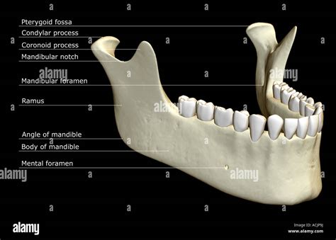 Lump On Lower Jaw Bone