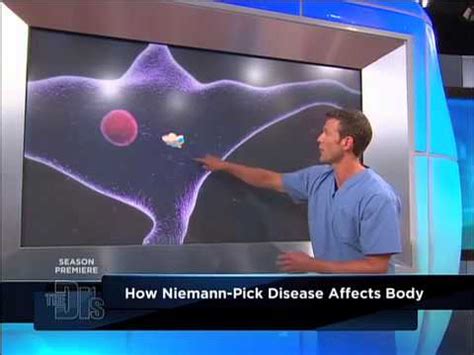 This disease is part of a group of disorders that cause bone and joint deformity as well as interference with normal growth. Niemann-Pick Disease Medical Course - YouTube