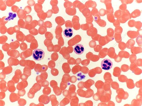 Blood Smear Lm Stock Image C Science Photo Library