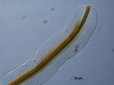 Microscopic View On The Filamentous Cyanobacterium Petalonema Alatum