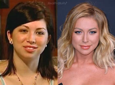 Photos See Vanderpump Rules Stassi Before Her Chin Implant She Reveals Plastic Surgery