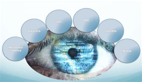 Artificial Intelligence In Ophthalmology By Antonio Castiglione