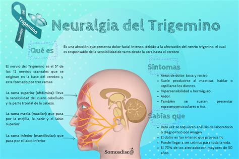 Día Internacional De La Neuralgia Del Trigémino Somosdisc
