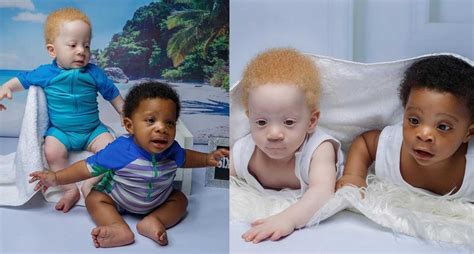 Nigerian Mom Shares Unique Story Of Black And White Twins