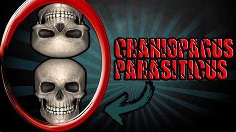 Craniopagus Parasiticus ☠ Youtube