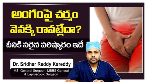 Ksr Stapler Circumcision For Tight Foreskin Phimosis Treatment In Telugu Circum Cure