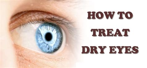 signs of dry eyes