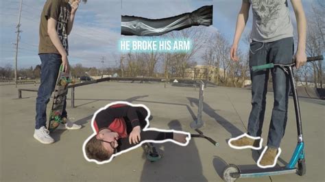 Kid Breaks Arm At Skatepark Youtube