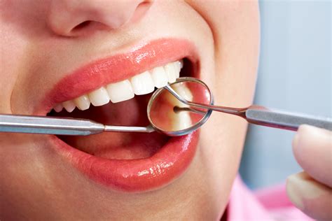 Teeth Cleaning Algodones Dentists Guide
