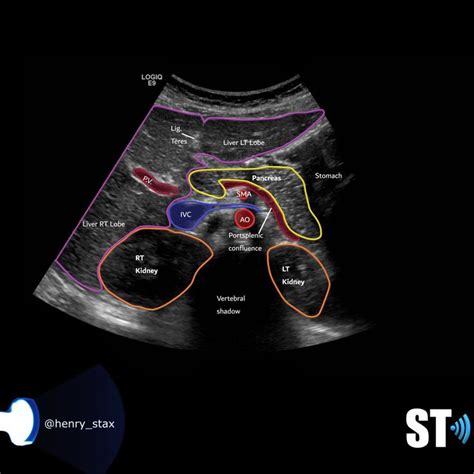 Liver Anatomy And Protocol Medical Ultrasound Liver Anatomy