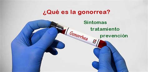 Qué es la gonorrea Síntomas tratamiento y prevención