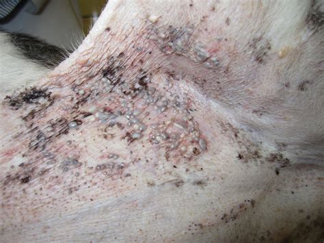 Image Gallery Common Skin Masses Clinician S Brief