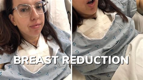 Breast Reduction Experience Week Post Op Insurance Preparation J To C Youtube