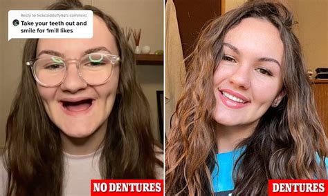 22 Year Old Woman Who Lost All Her Teeth To Meth Reveals What Its Like