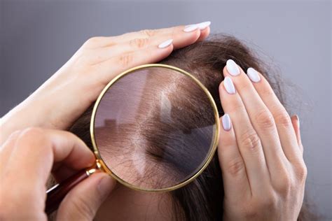Hair Cuticle Everything You Need To Know