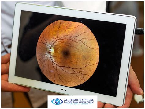 5 Diseases That Retinal Imaging Can Detect