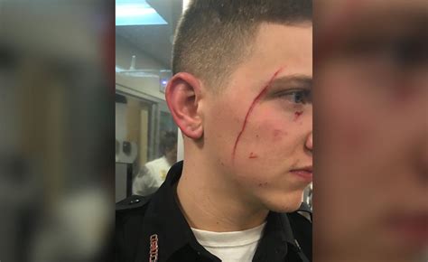 Correction officer slashed by inmate at Rikers hours after public hearing about violence against 