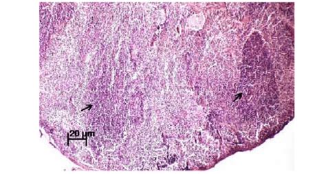 Normal Histological Appearance Of Spleen Tissue Of Control Mice By He