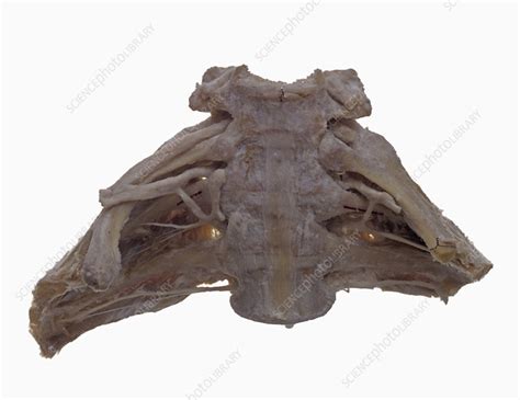Cadaver Dissection Stock Image C0126316 Science Photo Library