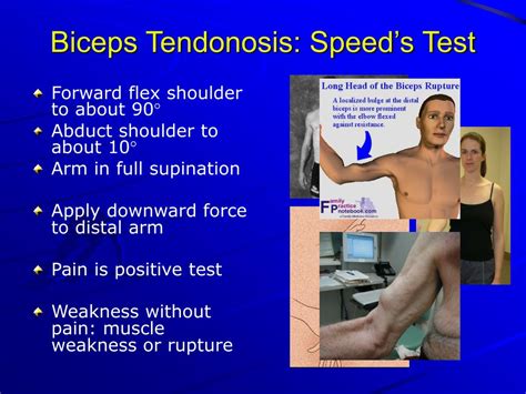 Ppt History Physical Examination Of The Shoulder Powerpoint