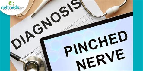 Pinched Nerve Causes Symptoms And Treatment
