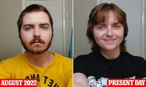 Transgender Woman Reveals How Hrt Transformed Their Face In Fascinating