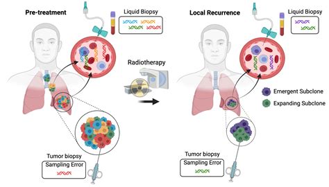 Molecular Radiobiology With Liquid Biopsies Encyclopedia