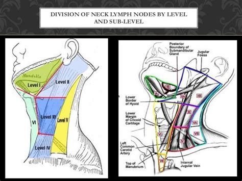 Level 5 Neck Dissection Elective Neck Dissection May Be Unnecessary