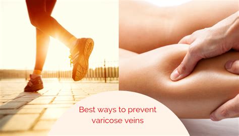 What Are The Best Exercises To Prevent Varicose Veins Drabhilash