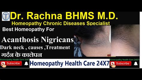 Homeopathy For Acanthosis Nigricans Dark Neck गर्दन के कालेपन