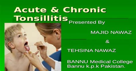 Acute And Chronic Tonsillitis And Their Management Ppt Powerpoint
