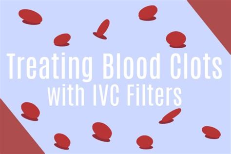 Blood Clots Archives Uva Radiology And Medical Imaging Blog For Patients