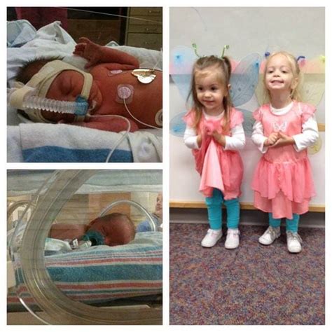 A Beautiful Gallery Of Preemie Twins Before And After Twiniversity