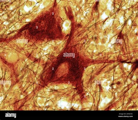 Multipolar Neuron Labeled Under Microscope