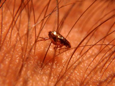 Fleas In Human Hair Symptoms And How To Stop This Menace