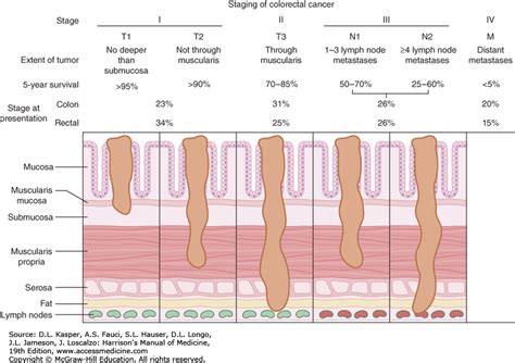 Colorectal Cancer Harrisons Manual Of Medicine