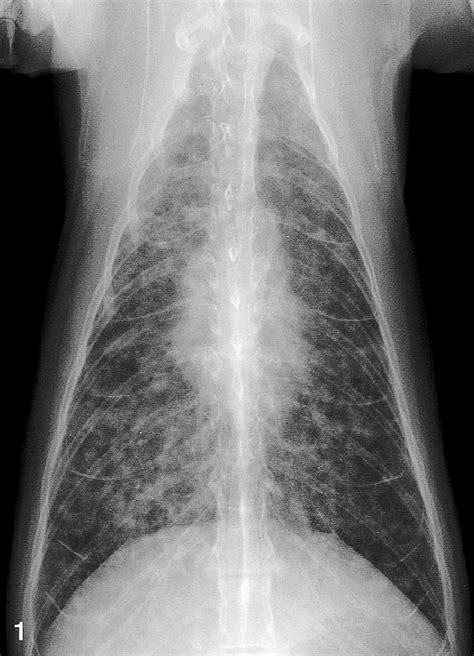 Lung Cat No 1 Diffuse Severe Bronchointerstitial Pattern