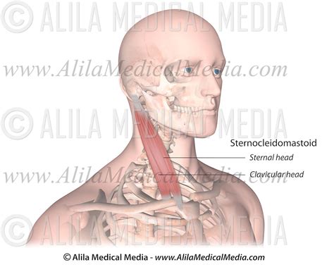 Sternocleidomastoid Alila Medical Images