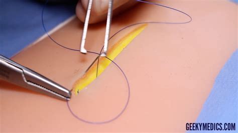 Subcuticular Suture Osce Guide Surgical Skills Geeky Medics
