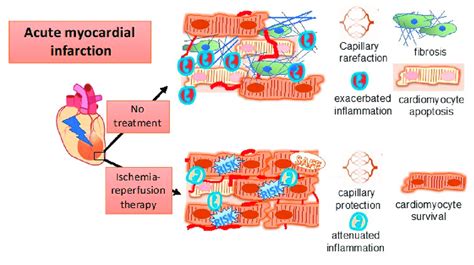 Key Players In Ischemia Reperfusion Injury Are Inflammation