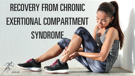 Recovery From Chronic Exertional Compartment Syndrome Cecs Youtube