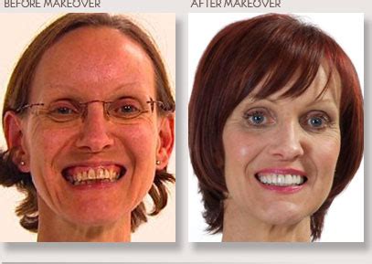 Protect your hands from the influence of the negative factors. Jane - 10 Years Younger: Series 5 - Dental Surgery Before ...