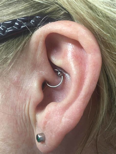 Cureus Daith Piercing Wonder Treatment Or Untested Fad