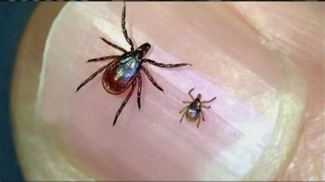 Beware Of Ticks Deadly Tick Disease On The Rise