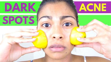 How To Apply Lemon On Face Rubbing Lemon On Face Youtube