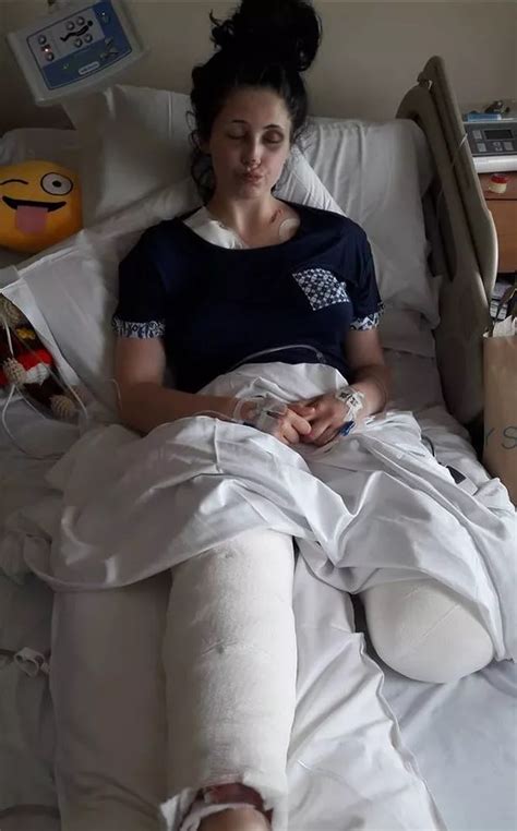 Marathon Beide Sorgfalt Amputee Leg Accident Woman Inspiration Kap